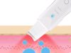 Ultrahangos kavitációs arc peeling, fehér, vezeték nélküli, hordozható